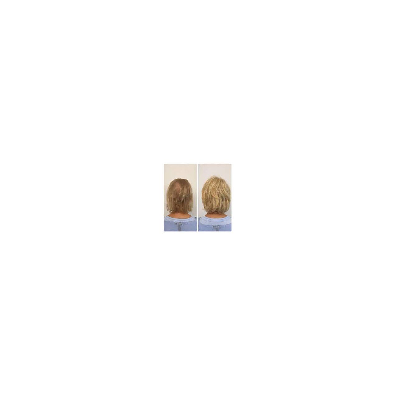 Eye-Brow-Hair Booster